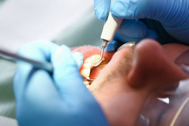 Best Emergency Broken Tooth Repair in Galena, IL